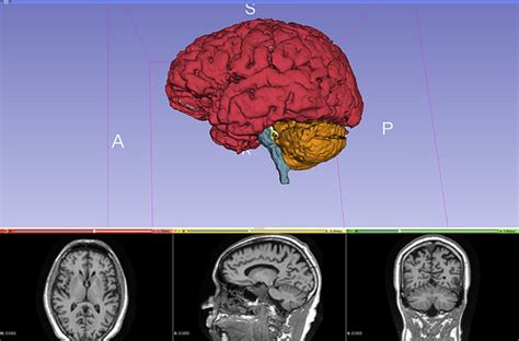 Diseñan semáforo inteligente - Mi Patente