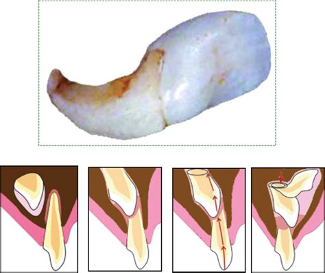 Tooth development – Histology and Embryology for Dental Hygiene