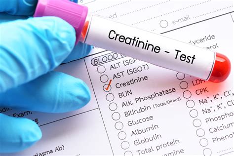 Creatinine Test: High, Low, & Normal Levels - SelfDecode Labs