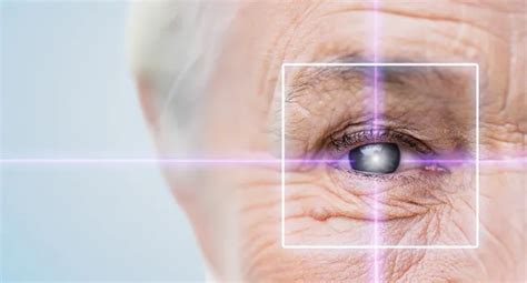 Cataract Surgery With Glaucoma: Is It Safe? - Centre For Sight