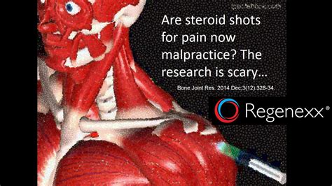 Shoulder Steroid Injection Side Effects: Shocking New Research! - Regenexx®