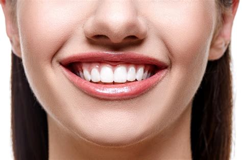 Whitening Teeth at Our Dentist Office in Milton Ontario