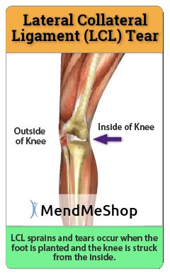 Pin on Knee Sprain Recovery Guide