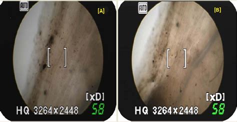 Microscopic images of nasal mucosa. (A) Control (Normal) (B) F1 ...