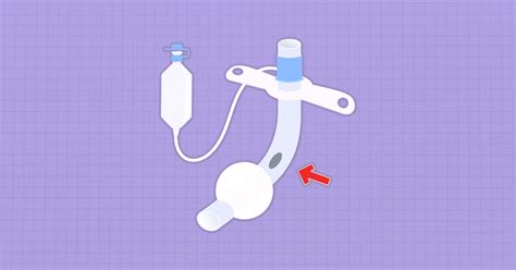 Fenestrated vs Non-Fenestrated Tracheostomy Tube [Explained]