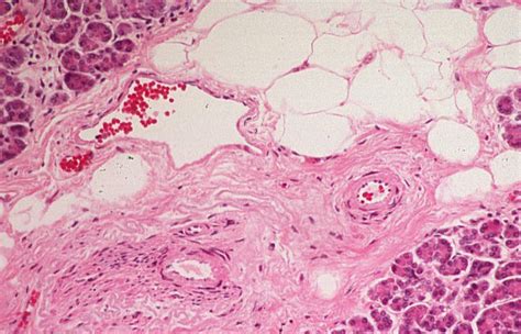 Basic Histology -- Artery and Vein