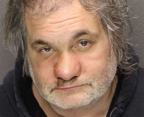 Artie Lange’s Nose Collapsed Due to Cocaine