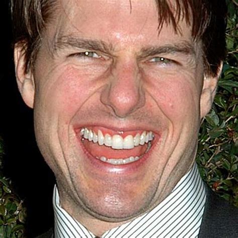 Celebrities with Bad Teeth (13 pics) - Izismile.com