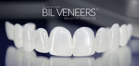 BIL VENEERS from Brighter Image Lab $800+ | Cosmetic teeth, Dental veneers, Veneers teeth