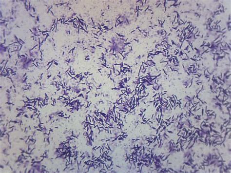 Eisco Prepared Microscope Slide - Escherichia Coli Smear, Gram Stain Microbiology | Fisher ...
