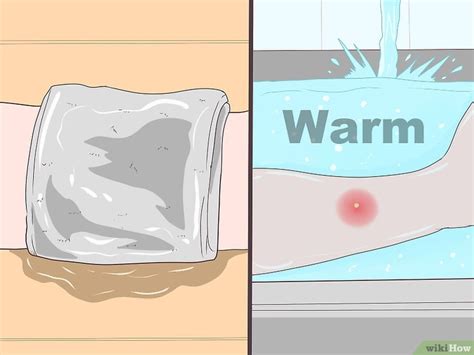 How to Remove pus from a wound