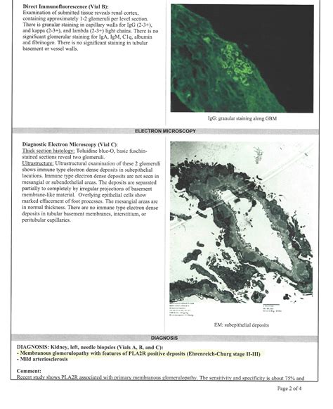 Kidney biopsy review : r/medical