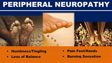 Peripheral Neuropathy: Causes, Symptoms, and Treatment - Helal Medical