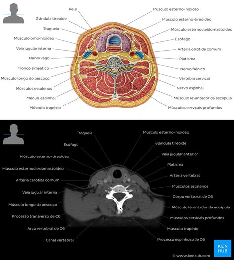 Imaginologia e anatomia radiológica: Raios x, TC, RM | Kenhub