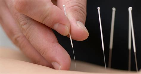 Acupuncture | Hawthorn Healing Arts Center