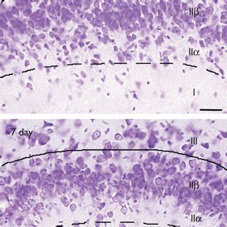 The piriform cortex is fully reconstituted by 1 month after bulbotomy.... | Download Scientific ...