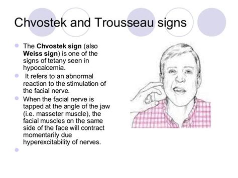 Chvosteks Sign