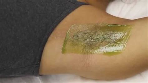 Women's Hair Removal-Underarm Waxing Treatment in Manhattan New York - YouTube