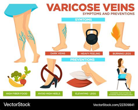 Varicose veins symptoms and preventions poster Vector Image