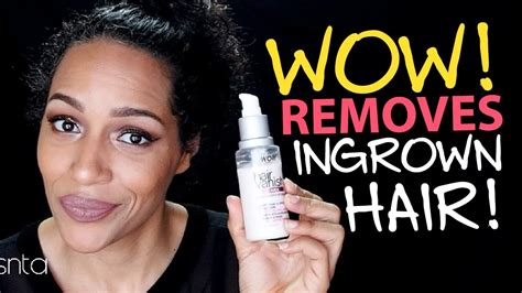 Ingrown Hair On Lip Woman | Lipstutorial.org