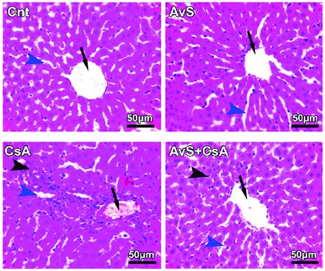 Representative comet assay images show the influence of treatment with ...