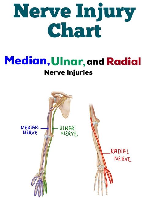 Nerve Injury/dysfunction Chart median Ulnar & Radial - Etsy Canada in 2023 | Radial nerve, Ulnar ...