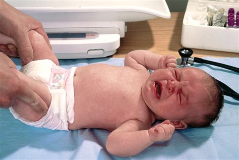 Congenital screening for newborns and infants | GPonline