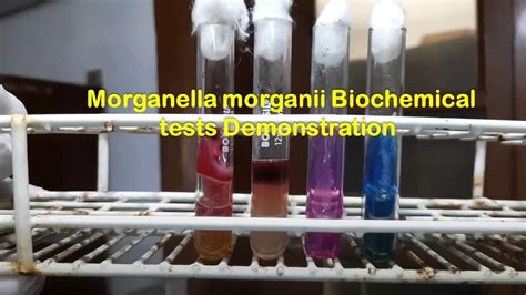 Morganella morganii Biochemical tests Demonstration - YouTube