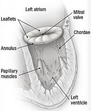 What causes a leaky mitral valve? - Harvard Health