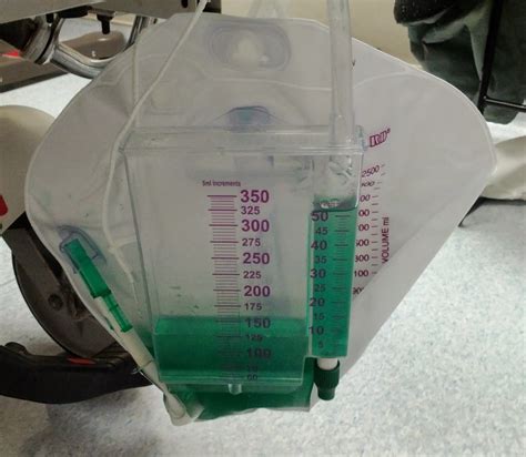 Propofol Infusion Syndrome