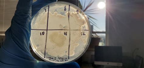 Not your typical post, but here is a sample of Mycobacterium smegmatis ...