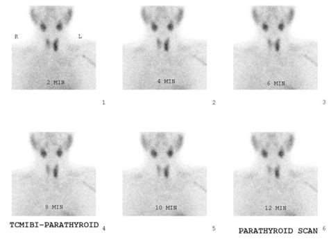 mibi | Titan Radiology