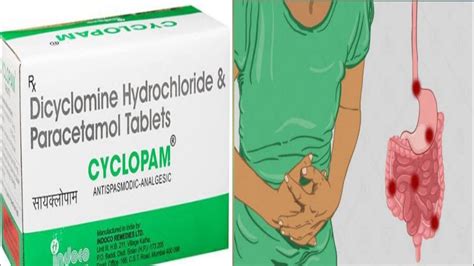 cyclopam tablet review in Hindi / abdominal pain / use / dose/ side effects - YouTube