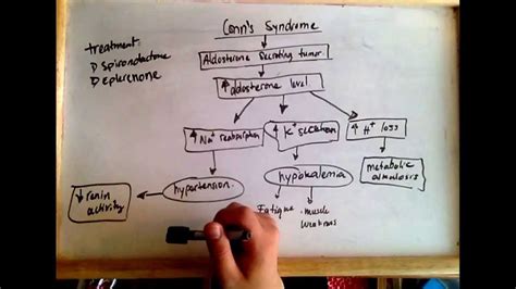 Conn's syndrome (hyperaldosteronism) - cause and treatment - YouTube