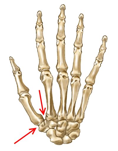 How to treat a jammed thumb – Dustin Pedroia – The Disabled List