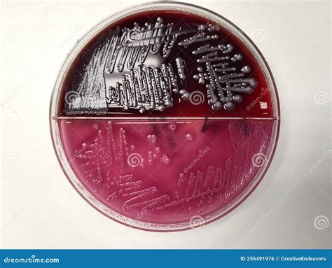 E. Coli Bacteria Growing On Blood And Macconkey Agar Royalty-Free Stock Image | CartoonDealer ...