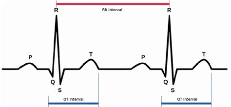 Long QT syndrome causes, symptoms, diagnosis, prognosis and treatment