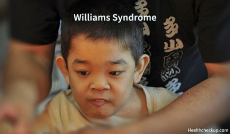 Williams Syndrome Life Expectancy, Causes, Symptoms, Treatment