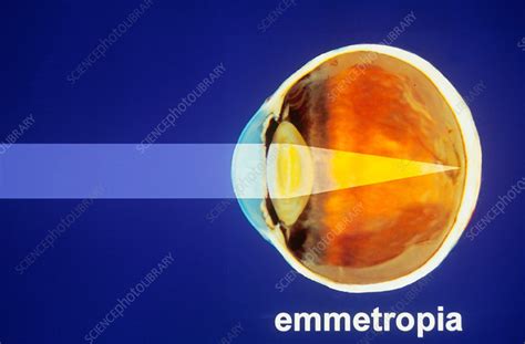 Emmetropia Diagram - Stock Image - C004/8227 - Science Photo Library