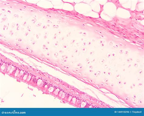 Histology of Trachea Human Tissue Stock Photo - Image of squamous ...