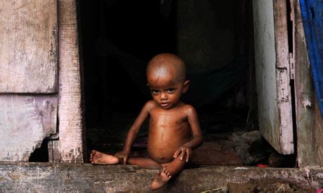 Over 40% of Indian children are malnourished, report finds | World news ...