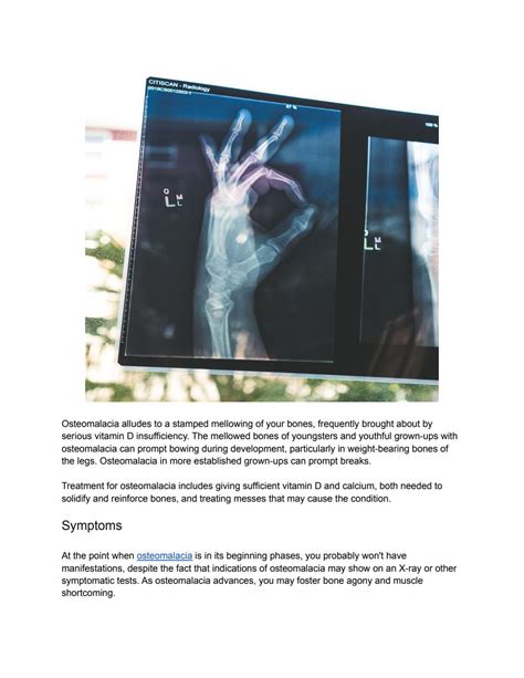 Osteomalacia - Causes, Symptoms & Diagnosis by Swati Patel - Issuu