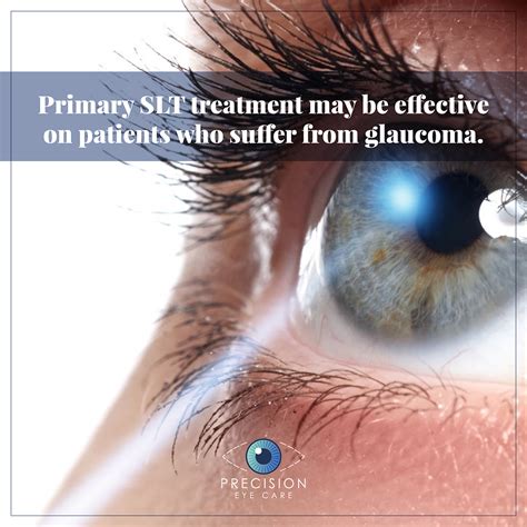 Selective Laser Trabeculoplasty (SLT) treatment - Precision Eye ...