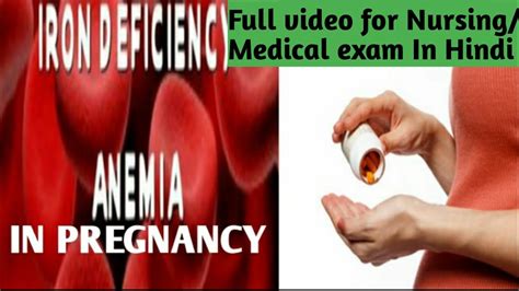 IRON DEFICIENCY ANEMIA IN PREGNANCY II PART-2 II PROBLEM DURING PREGNANCY II NURSING ACADEMY ...