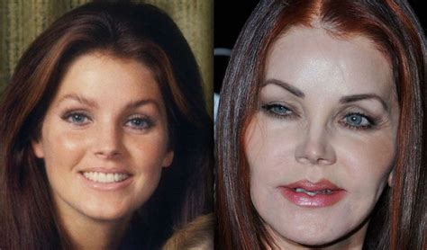 Understanding The Priscilla Presley Plastic Surgery | Priscilla presley plastic surgery, Plastic ...