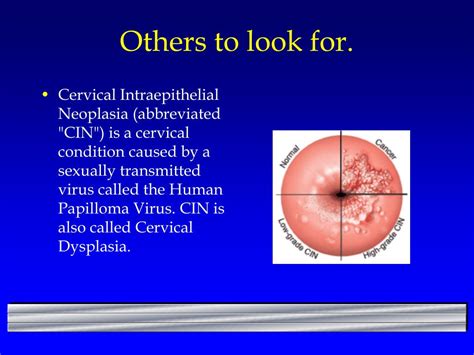 PPT - Colposcopy PowerPoint Presentation, free download - ID:1703513