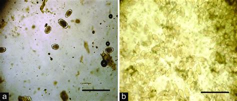 (a) Strongylus eggs, (b) Oxyuris equi eggs with cellophane tape ...