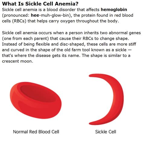 Anemia, sickle cell; Hemoglobin S Disease