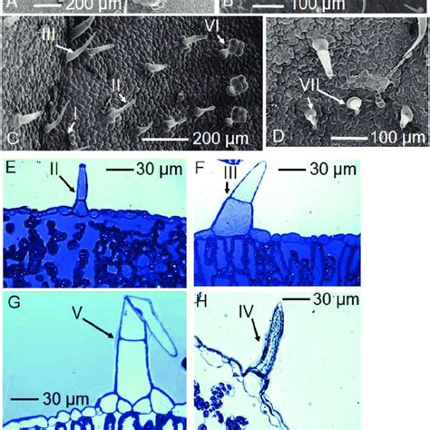 Trichomes on the leaf surface of tomato. The seven types are indicated... | Download Scientific ...