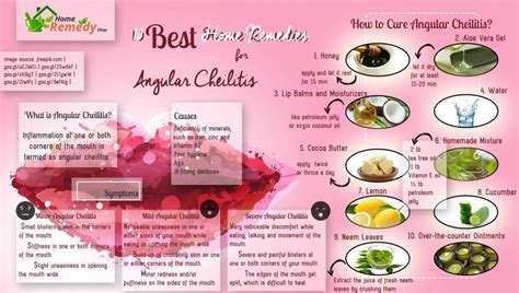 10 Best Home Remedies for Angular Cheilitis - Home Remedies